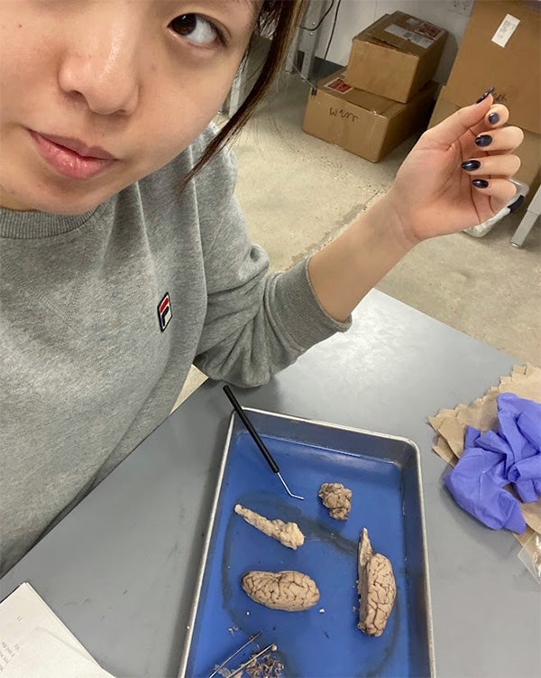 Selfie of partially-hidden person showing plate with cheep brains