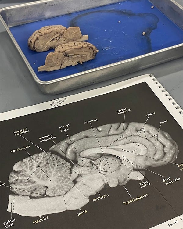 Printed diagram of a brain next to a live brain